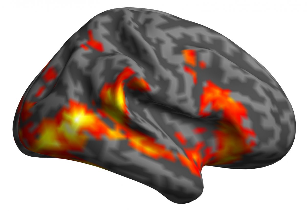 Rycina przedstawiająca wzrost aktywności obszarów mózgu obserwatora, związanych z dostrzeganiem ruchu i emocji, m.in. kora wzrokowa, bruzda skroniowa górna, wyspa