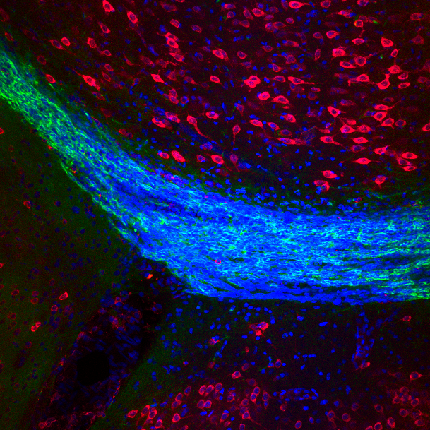 Zdjęcia mikroskopowe przedstawiające migrujące neuronalne komórki progenitorowe w przednim strumieniu migracji, skrawek strzałkowy mózgu myszy. Kolor zielony: marker komórek migrujących (PSA-NCAM) , niebieski: jądra komórek (Hoechst), czerwony: marker aktywnego białka mTOR (pS6).