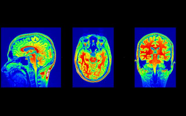 Anatomical brain images taken by MRI