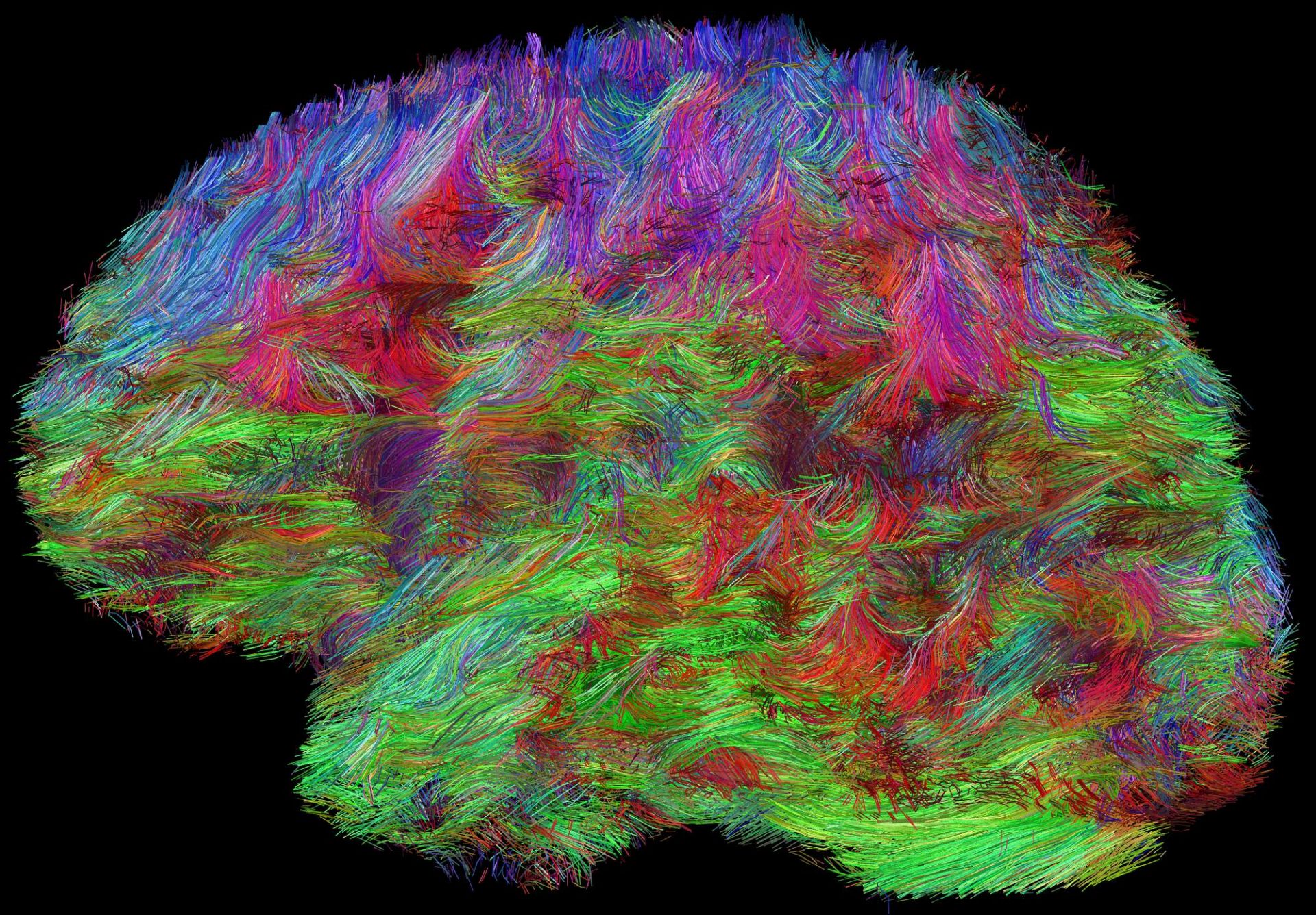 Rekonstrukcja połączeń anatomicznych w ludzkim mózgu, uzyskana za pomocą metody obrazowania dyfuzji molekuł wody w rezonansie magnetycznym