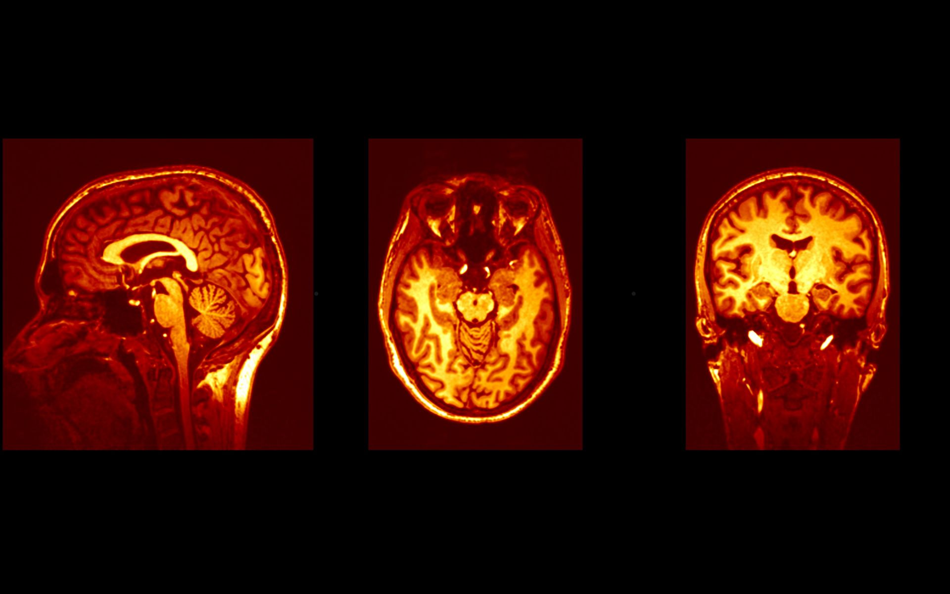 Obrazy anatomiczne ludzkiego mózgu uzyskane za pomocą rezonansu magnetycznego
