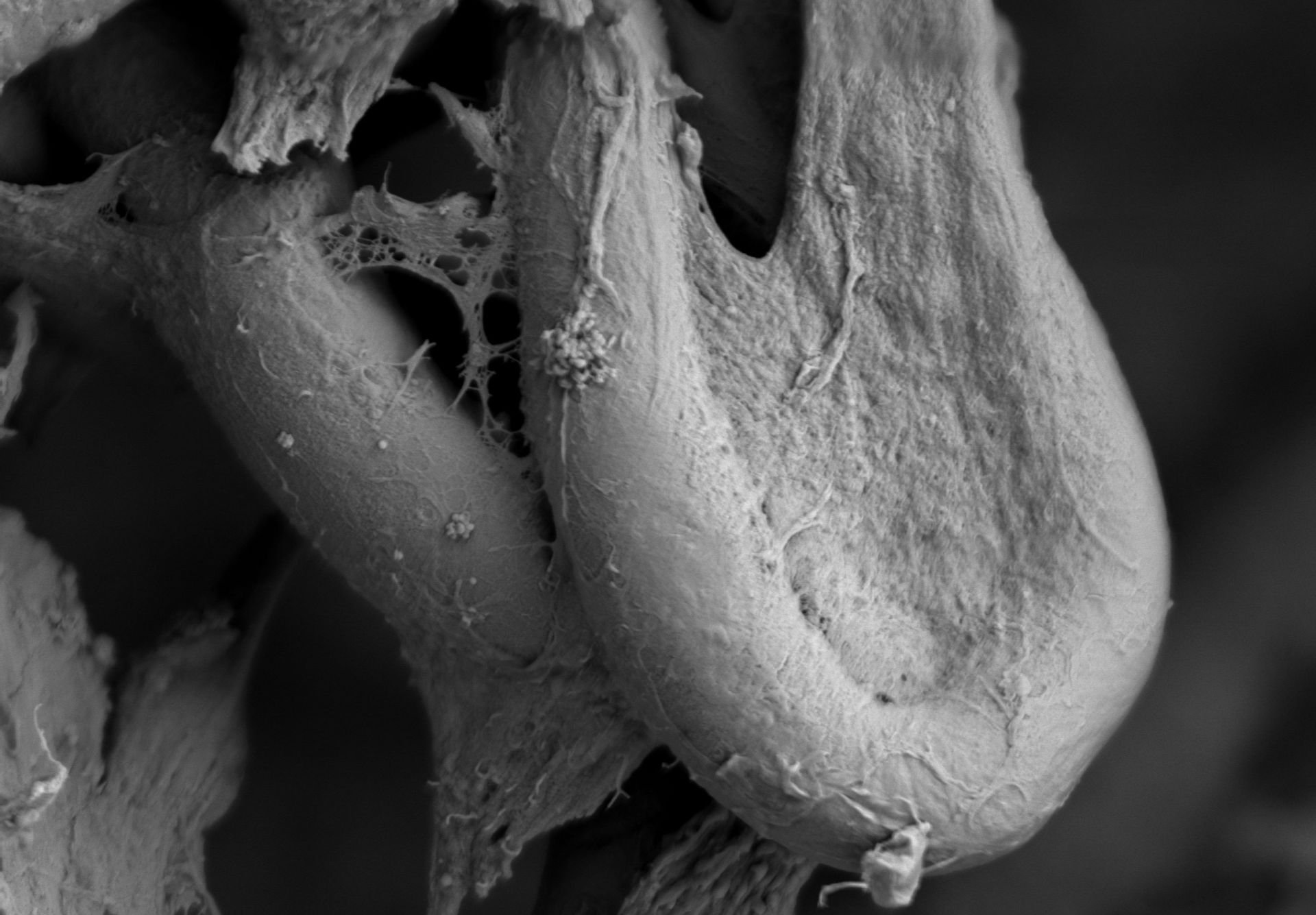 SEM microphotograph showing L929 cells grown for 144 hours on fibres obtained using the “wet” electrospinning method