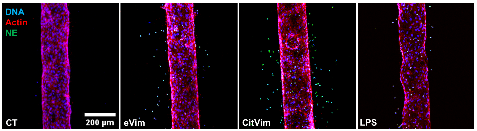 Diapedesis of human neutrophils, untreated or stimulated by vimentin (Vim), citrullinated vimentin (CitVim), or lipopolysaccharide (LPS) in a 3D model of blood vessels. Neutrophil elastase (green), actin (red), DNA (blue).